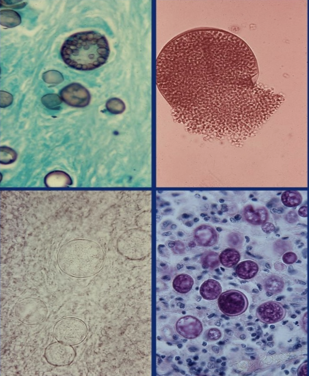 <p>Coccidioides immitis spherules</p>