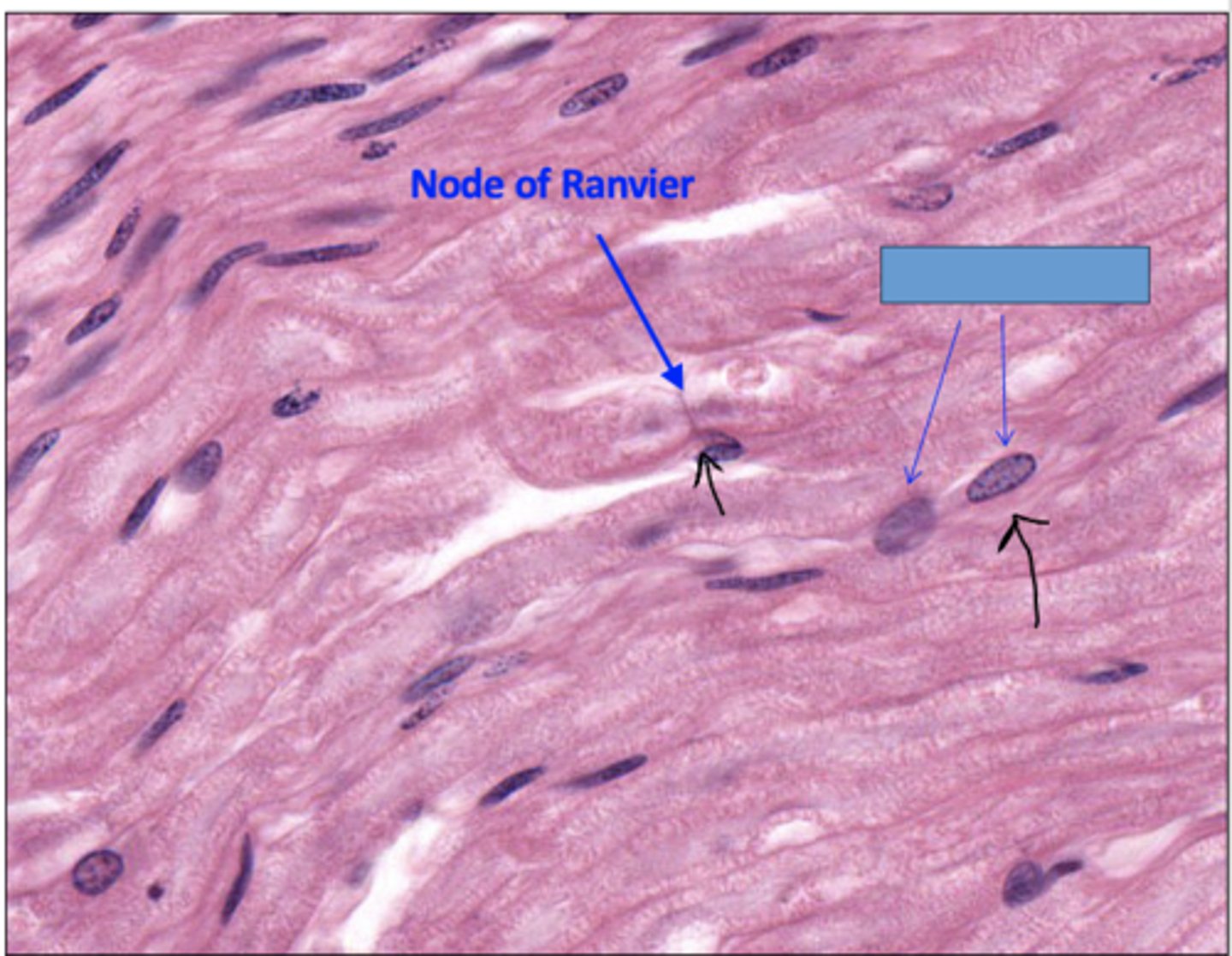<p>Identify the cells</p>