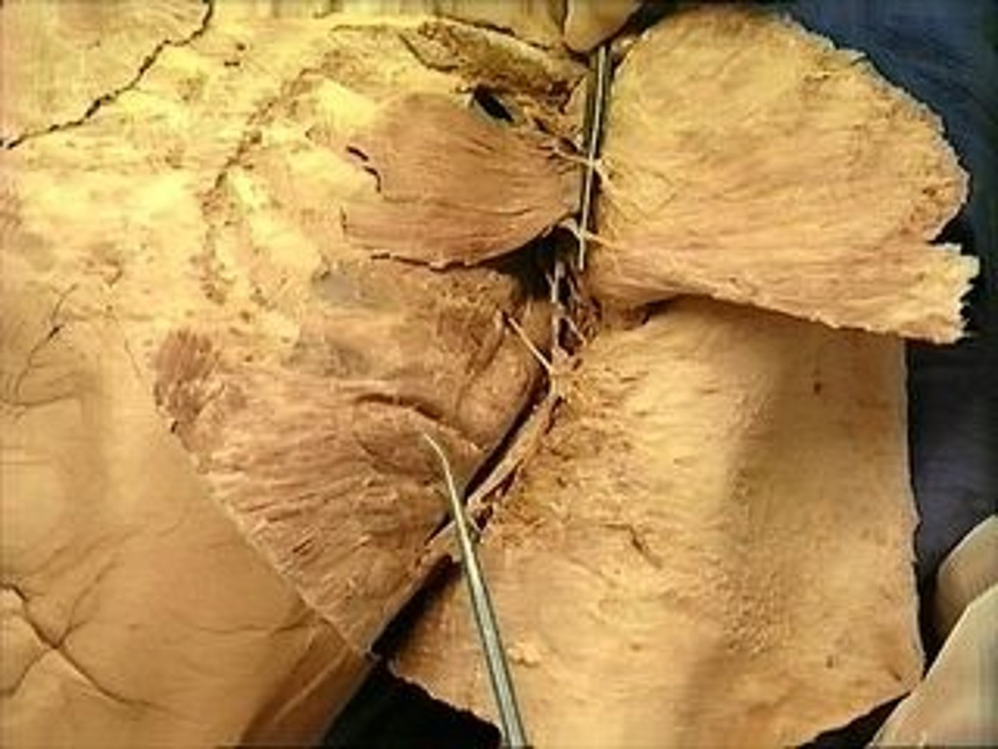 <p>*With Origin Fixed: Abduct The Scapula, Hold Medial Border Of Scapula Against Rib Cag; External surfaces of ribs 1-8</p>