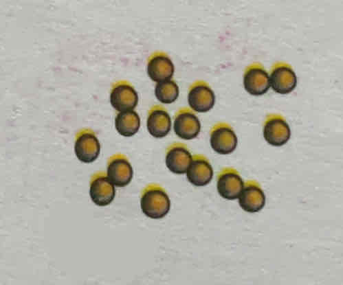 <p>What is the name of this bacteria…?</p>