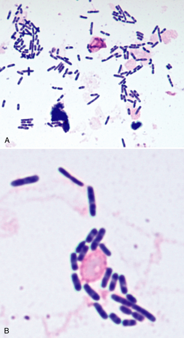 <ul><li><p>Gram -</p><ul><li><p>Non-lactose fermenter</p></li></ul></li><li><p>Bipolar Rods</p></li><li><p>Motile</p><ul><li><p>Except for Yersinia pestis</p></li></ul></li><li><p>Psychrophilic</p><ul><li><p>Able to withstand extreme low temperatures</p></li></ul></li></ul><p></p>