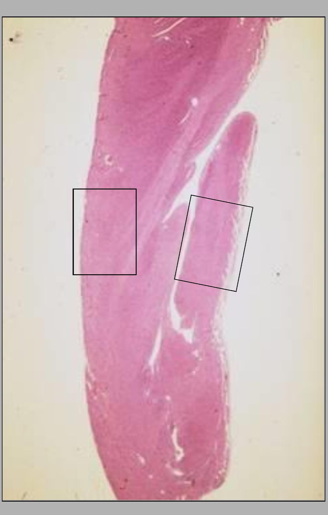 <p>Name of this slide? What is on the left side and the right side?</p>