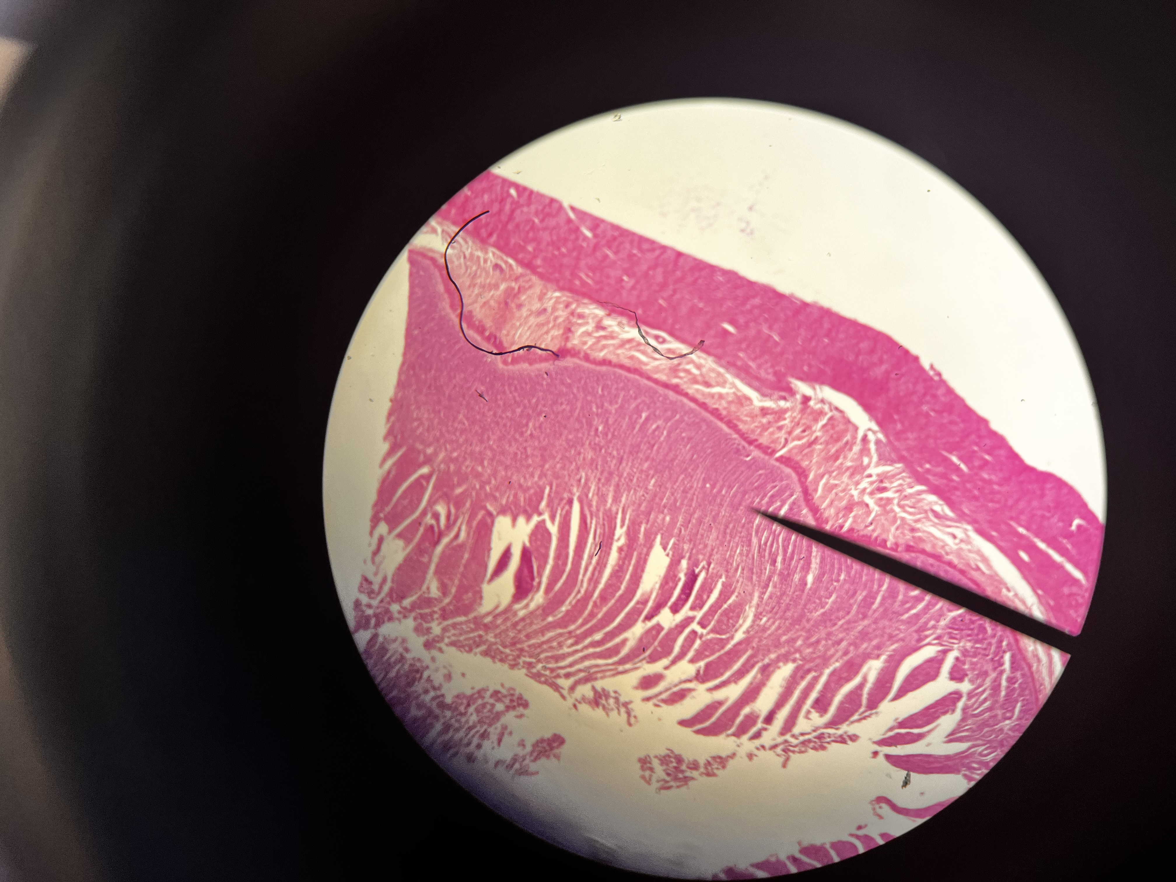 <p>identify the tissue (be specific)</p><p>Voluntary or involuntary?</p><p>Striated or not striated</p><p></p>