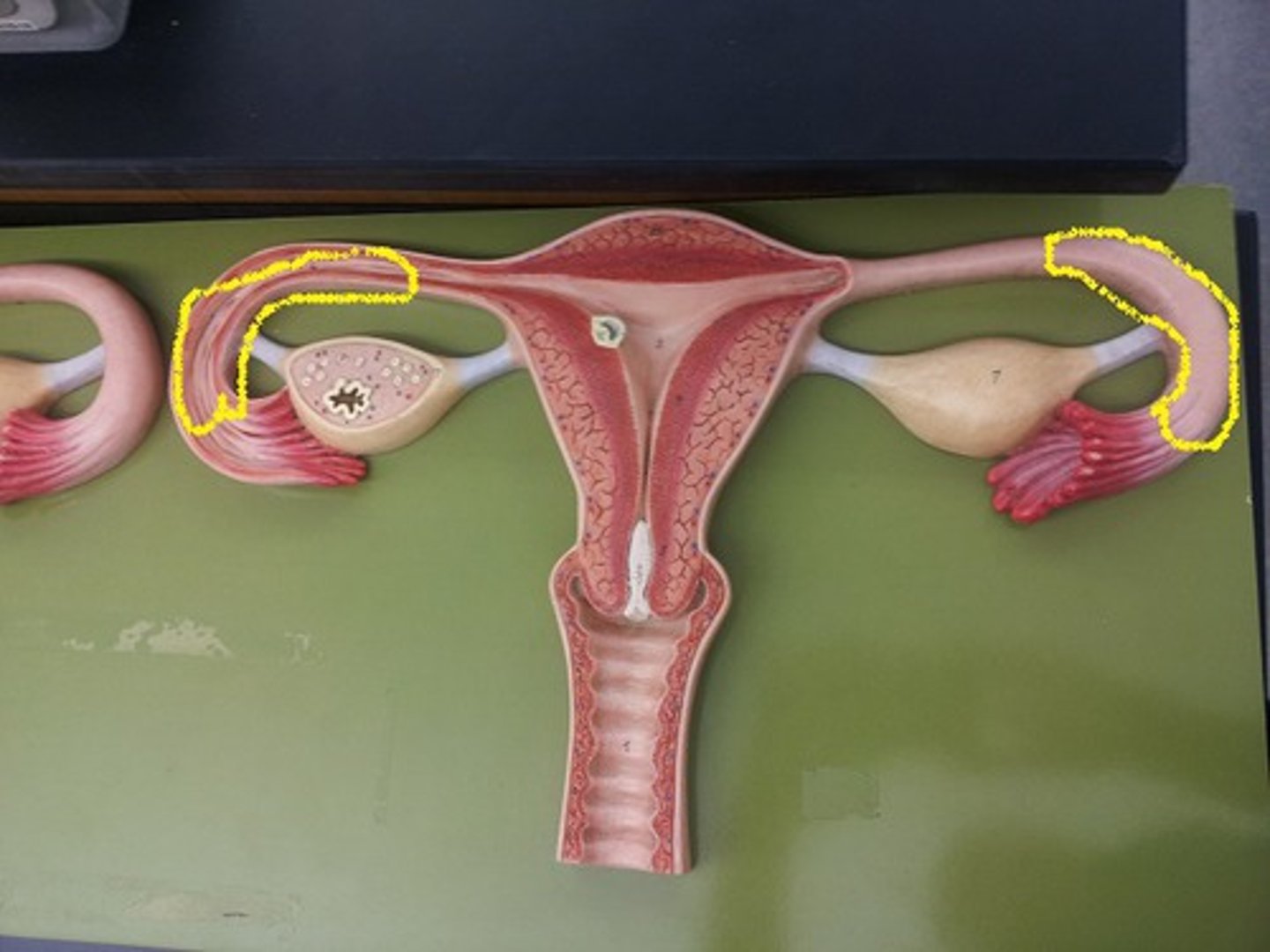 <p>Middle and longest section of fallopian tube.</p>