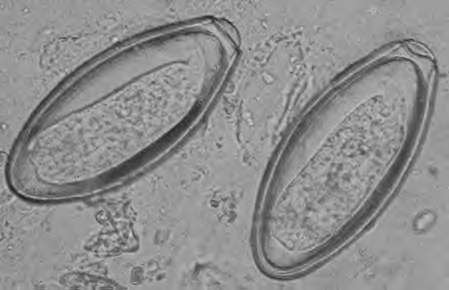 <p>pinworm</p><p>tail rubbing, scotch tape prep</p>