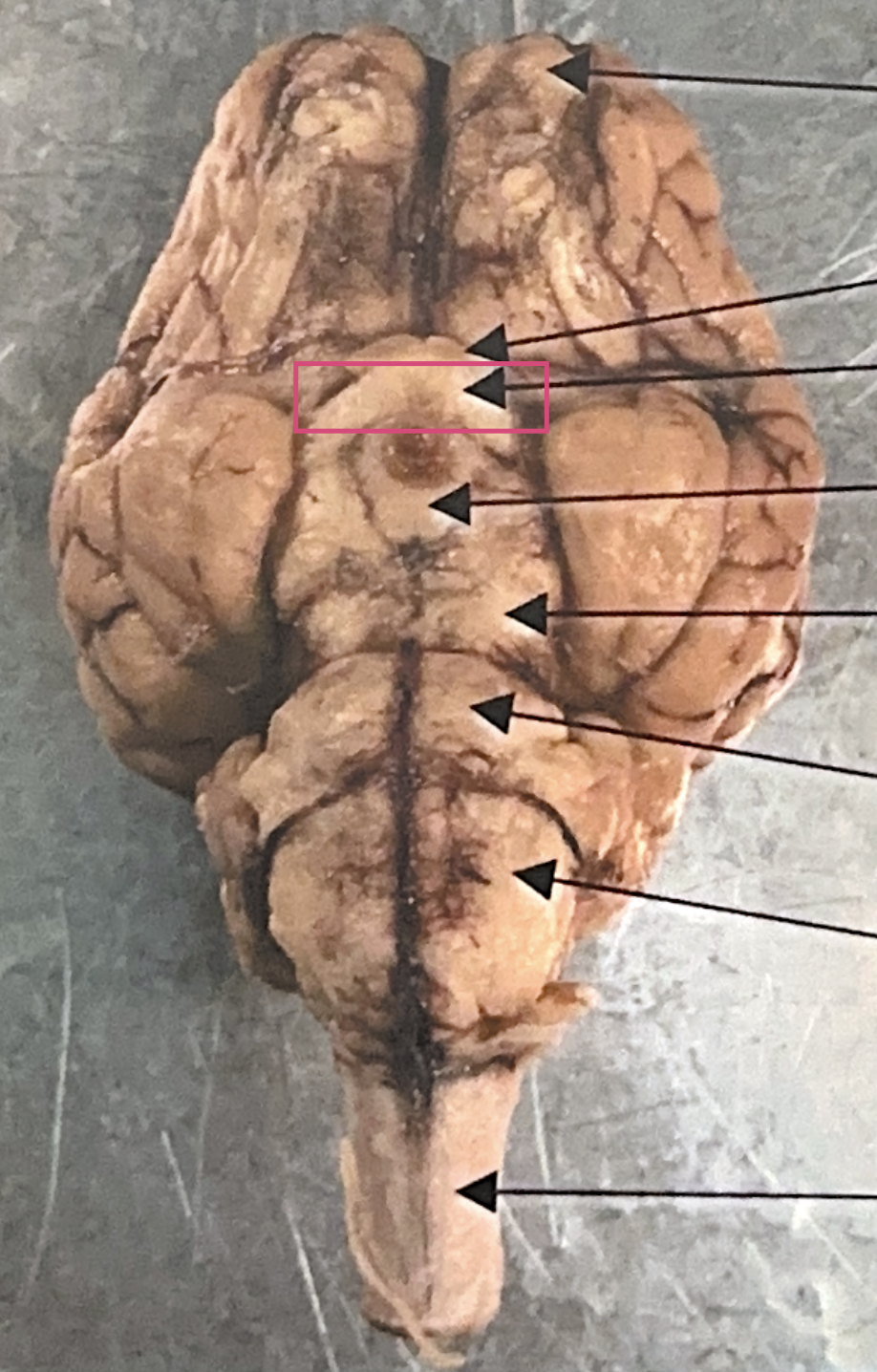 <p>What is this highlighted figure?</p>