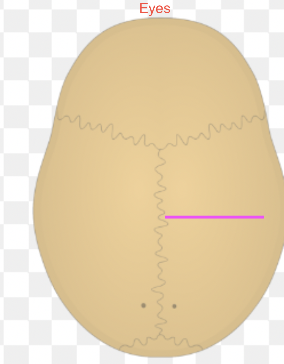 <p>What bone marking is this?</p>