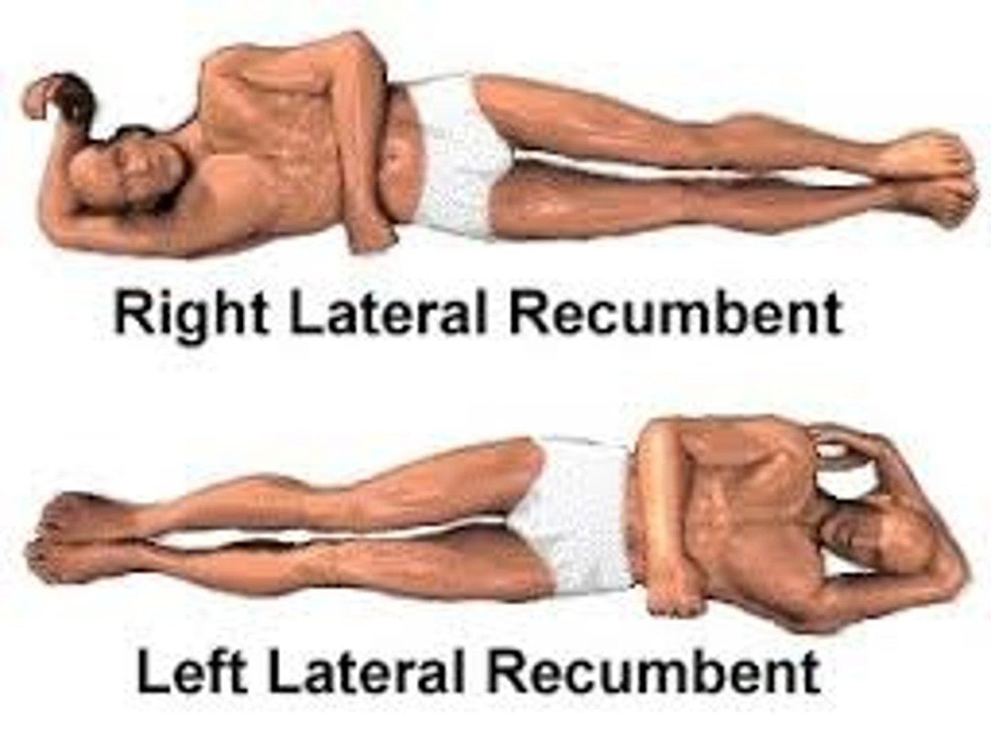 <p>Pt is lying on his side.</p><p>A pt lying on the left side would be the left lateral decubitus position. Right side is right lateral decubitus.</p><p>Used for x-rays.</p>
