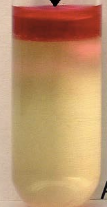 <p>Is this a positive or negative Indole test?</p>