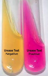 <p><mark data-color="yellow">Media variations - urease</mark></p><p>Can you label, describe and explain what this diagram is/shows?</p>