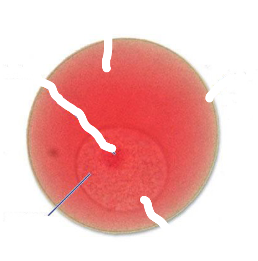 <p>What part of a starfish egg is this?</p>