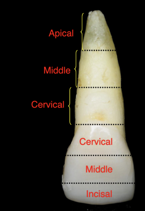 <p>cervical, middle, apical</p>