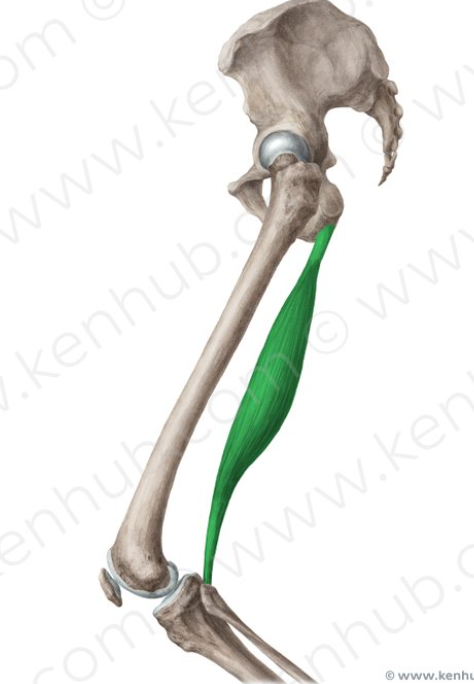 <p>Semitendinosus origins/insertions</p>