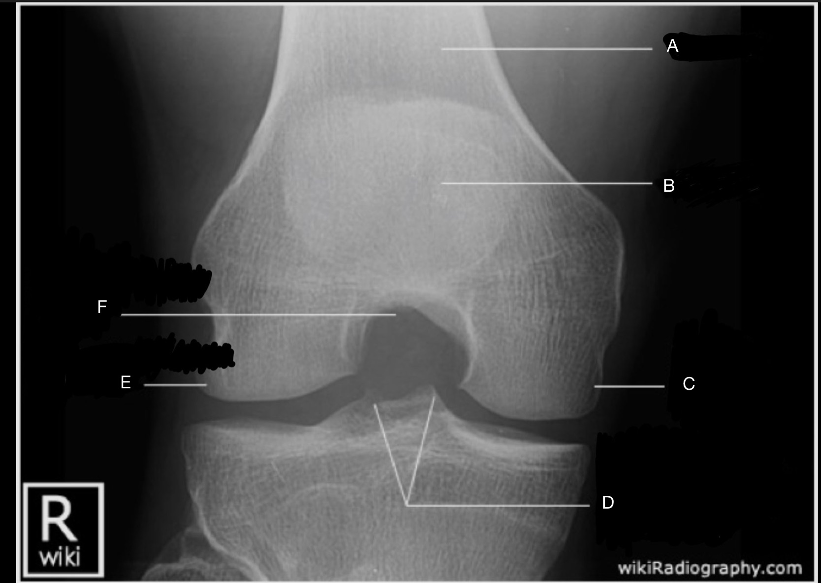 <p>Label the image.</p>