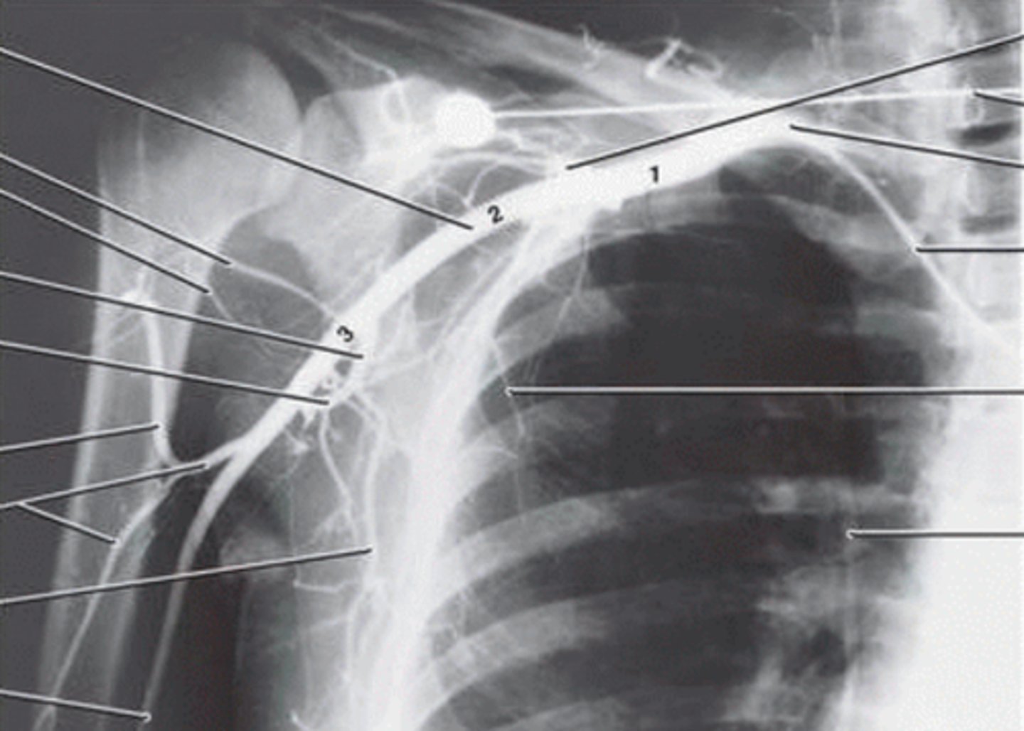 <p>Where are each of the 3 parts of the axillary artery located?</p>