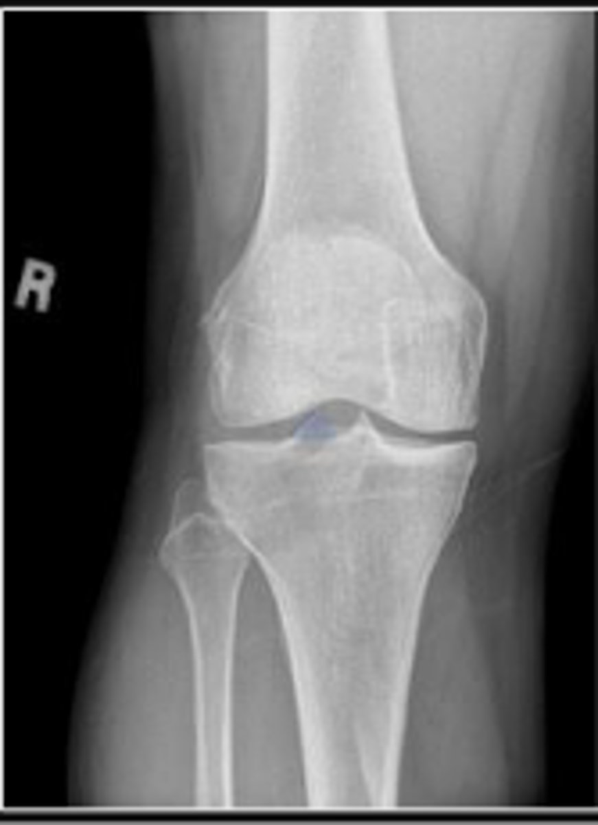 <p>What is outlined?</p>