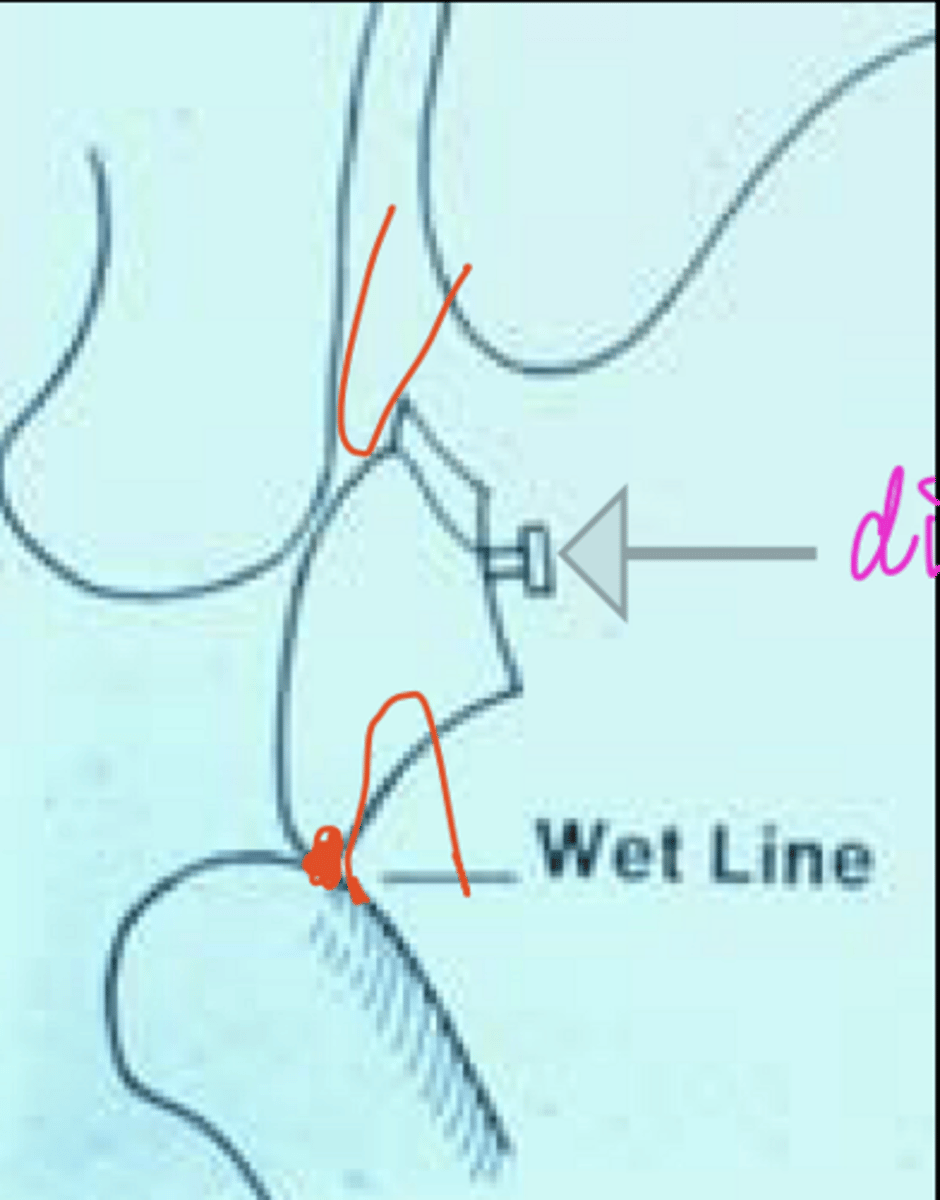 <p>whats the arrow pointing to? what sounds associated with wet line</p>