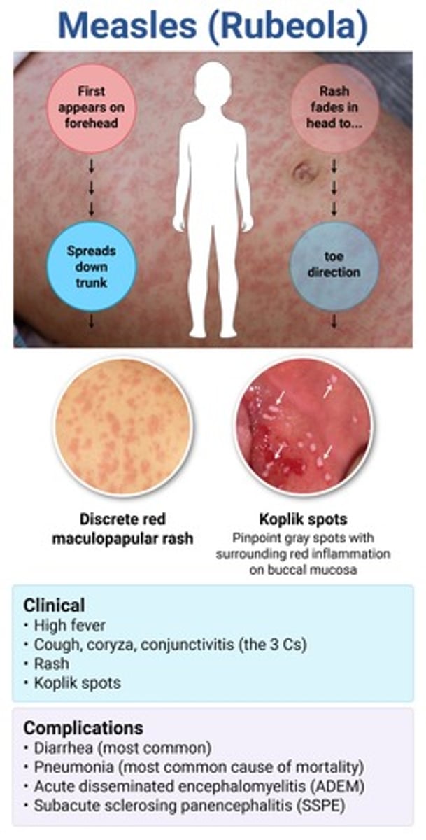 <p>rubeola (1st disease) → koplik spot pathognomonic</p><p>*etio = measles virus from paramyxovirus</p><p>give vit A for young/severely malnourished children to ↓ risk of complications/death</p>