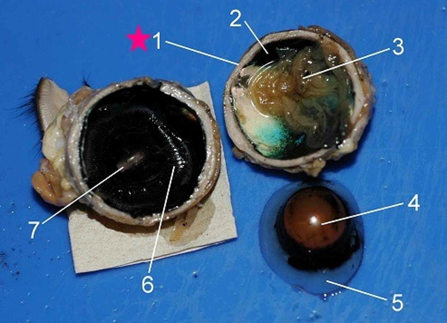 <p>white of the eye</p>