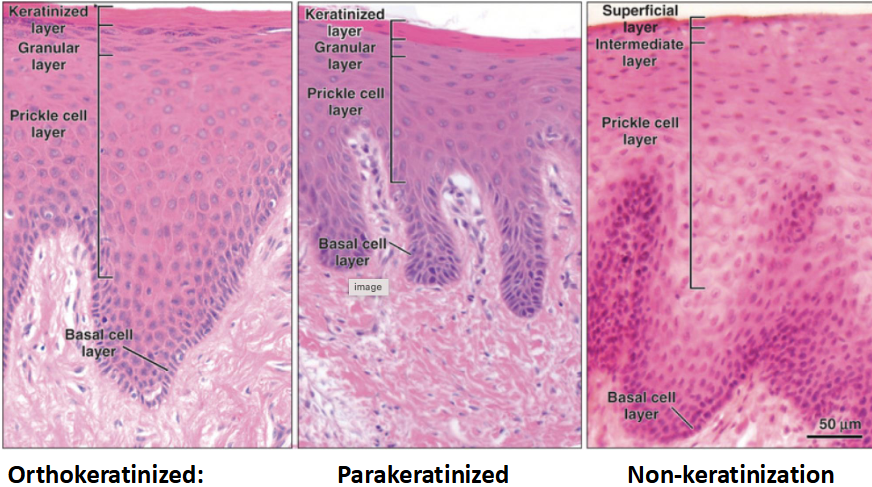 <p>What are the types of keratinization?</p>