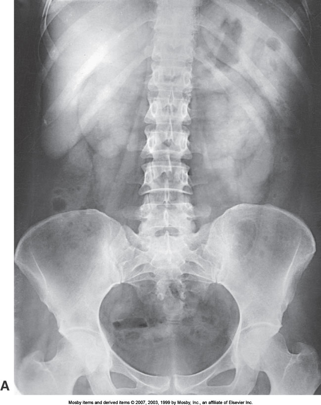 <p>What position is demonstrated?</p>