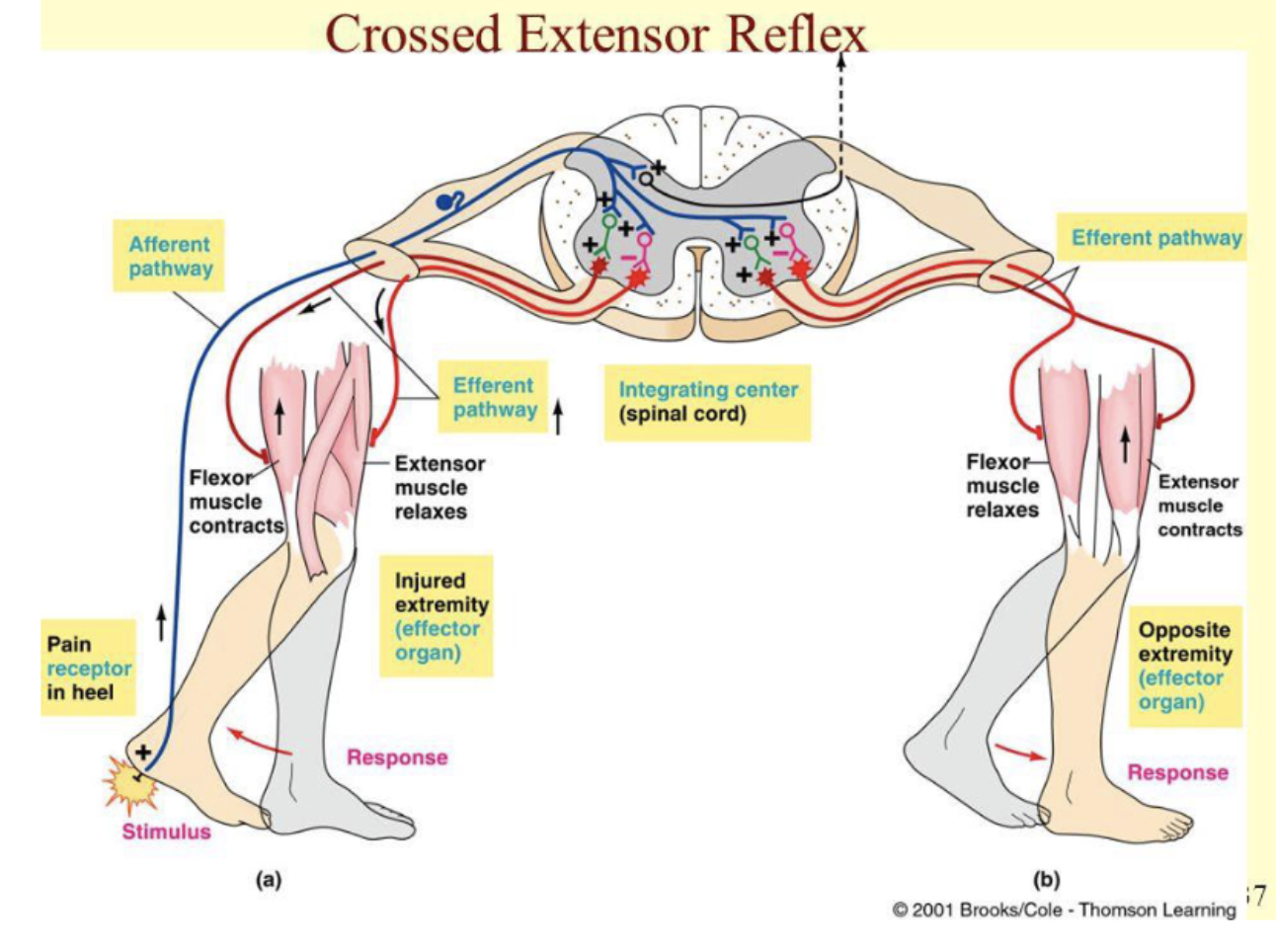 <p>type of double reciprocal innervation</p><ol><li><p>step on tack</p></li><li><p>foot withdrawn by contraction of flexors and relaxation of extensors</p></li><li><p>contralateral leg extend to support body</p></li></ol><p></p>