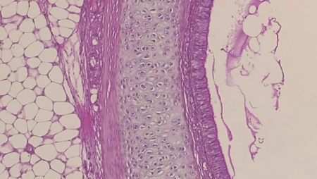 <p>What is the histology?</p>