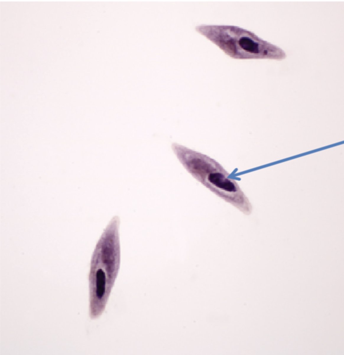 <p>protist</p><p>cilia not visible</p><p>macronucleus</p>