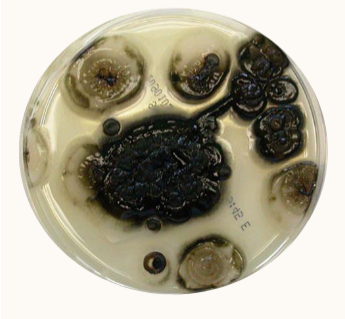 <ul><li><p><span><span>Starts as white, moist, creamy colonies</span></span></p></li><li><p><span><span>Develops brown/black shiny areas</span></span></p></li><li><p><span><span>Matures in 3-5 days</span></span></p></li><li><p><span><span>Reverse is black once mature</span></span></p></li></ul><p></p>