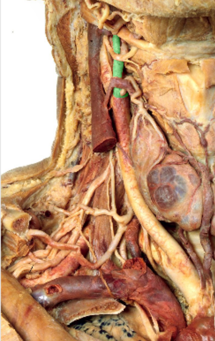 <p>Which artery?</p>