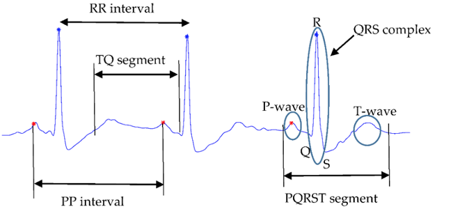 <p>What does this refer to</p><ul><li><p>Normal variant in young, healthy people</p></li><li><p>Often due to changes in vagal influence on the sinus node</p></li><li><p>Irregularity of the normal heart rate</p></li><li><p>Variation in the PP interval of &gt; 120 ms</p><p></p></li></ul><p></p>