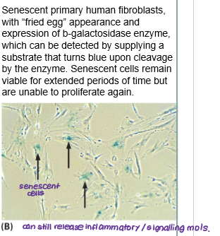 <p>What is senescence?</p>