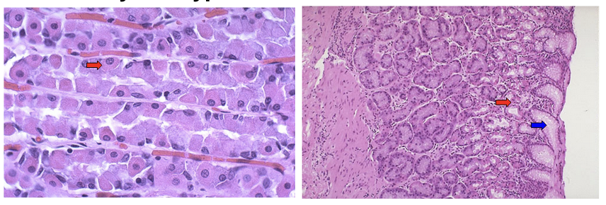 <p><span><strong>&nbsp;Identify cell type from stomach.</strong></span></p>