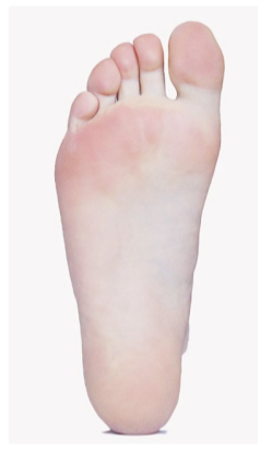 <p>related to sole—”palm” of the foot</p>