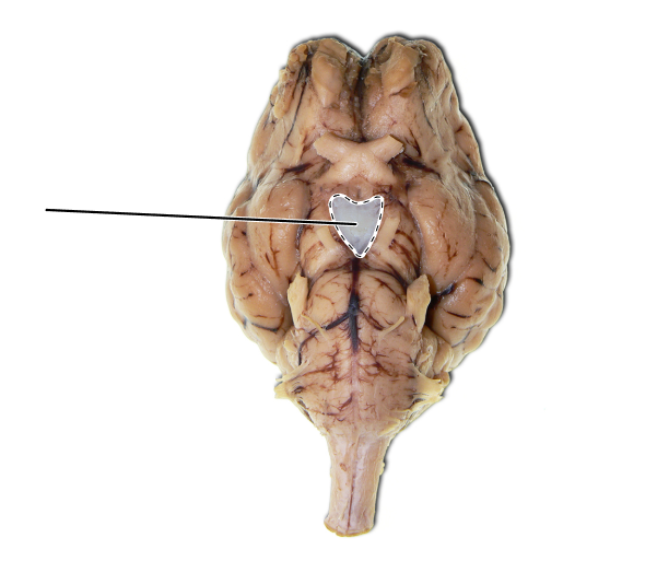 <p>Name the part of the brain that is highlighted.</p>