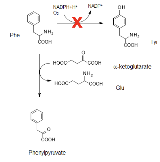 <p><strong><mark data-color="red" style="background-color: red; color: inherit;">Inborn error of metabolism</mark></strong> <strong>where there is an inactive phe hydroxylase</strong></p><p>which <strong>converts Phe → Tyr</strong></p><ul><li><p><strong>Loss of this results in a<u> transamination </u>between Phe and ⍺-ketoglutarate</strong></p></li><li><p><strong>Forming PPVA  (phenylpyruvate plus Glu)</strong></p></li><li><p><strong>Controlled by restricting Phe in diet</strong></p></li></ul><p></p>