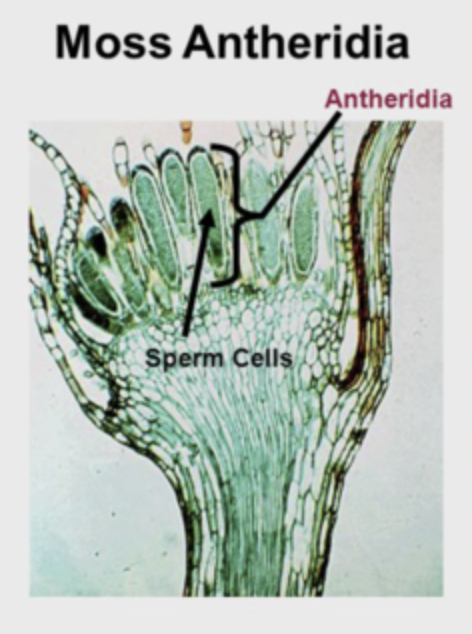 <p>Sperm</p>
