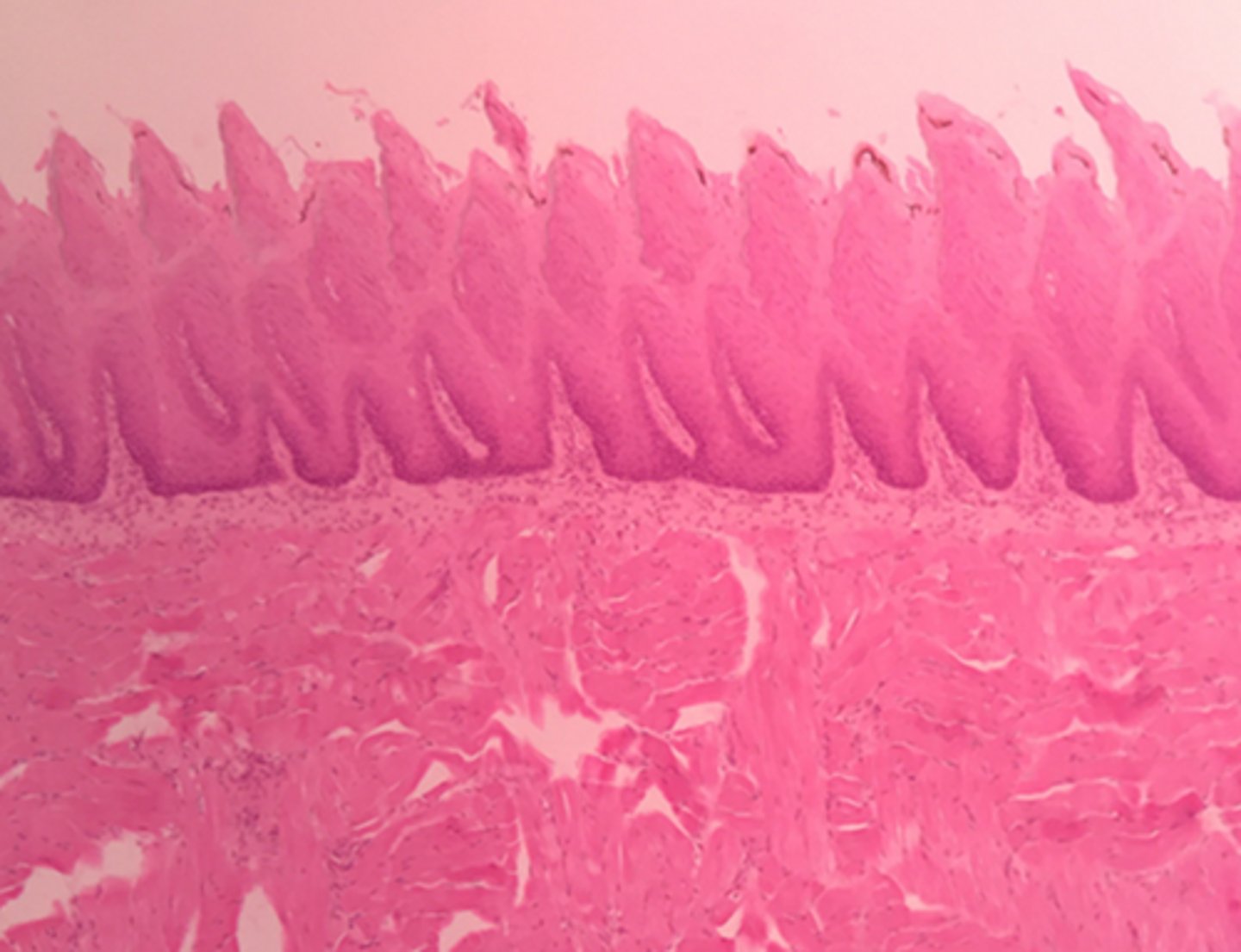 <p>Special: Taste</p><p>pointed, threadlike elevations on the entire surface of the tongue; contain tactile receptors; do NOT contain taste buds; increase friction of food in the mouth to enhance mechanical breakdown</p>