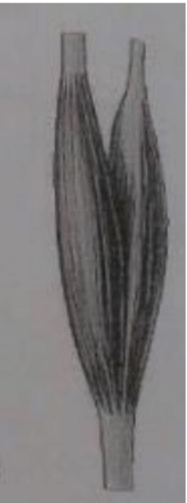 <p>Welchen Muskeltypus zeigt die Abbildung?</p><p>M. triceps</p><p>M. biventer</p><p>M. planus</p><p>M. biceps</p><p>Keines der Genannten</p>