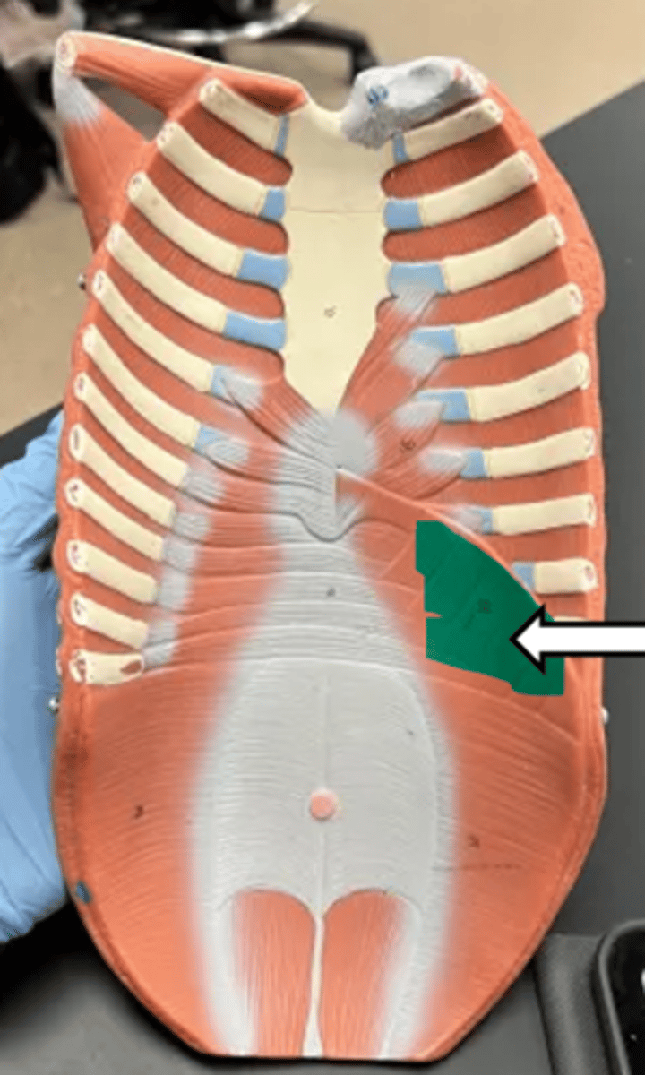 <p>name the muscle</p>