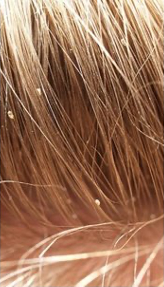 <p>what condition is this?</p>