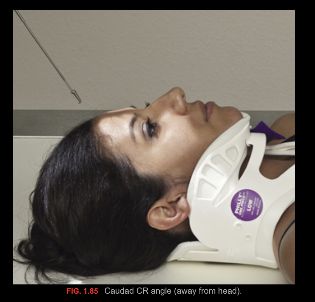 <p>Caudad/Caudal </p><p>(tube angles)</p>