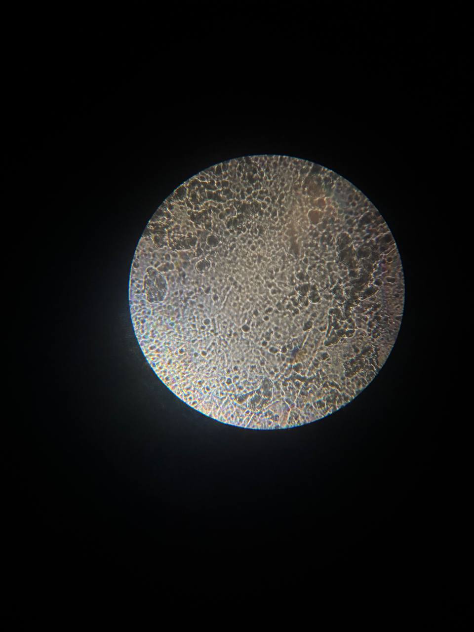 <p>Кора мозочка </p>