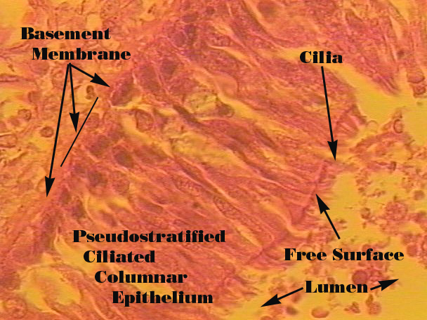 <p>Pseudostratified Columnar</p>