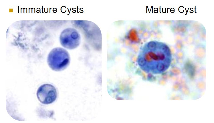 <p>entamoeba histolytica cyst </p>