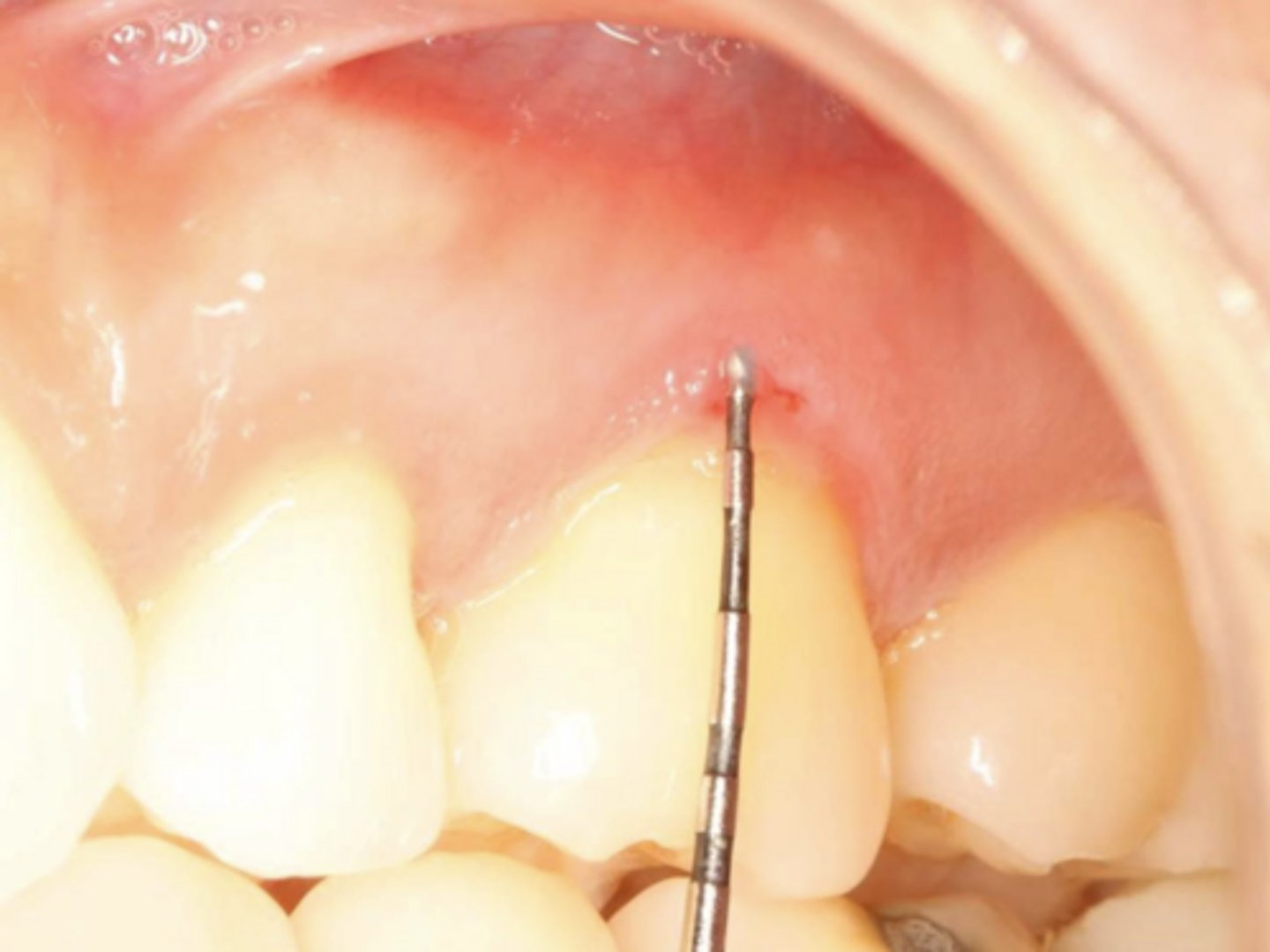 <p>What condition?</p>