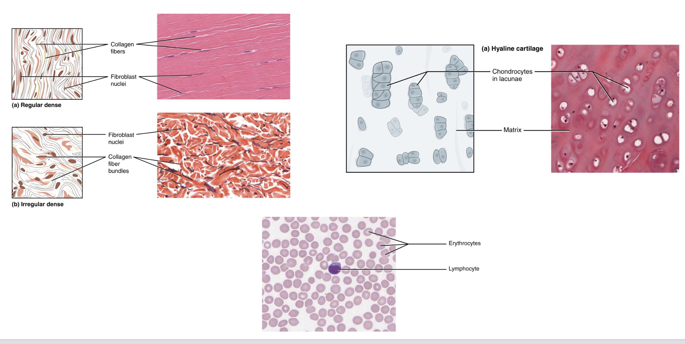 <p><strong>-consists of cells arranged in an extraceullar matrix</strong> <em>(=mixture of proteins surround by fluid)</em></p><p>-ex: fat and other soft padding tissue, bone, tendon, blood</p><ul><li><p><mark data-color="yellow" style="background-color: yellow; color: inherit;">Regular dense vs Irregualr dense:</mark> collagen fibers (flexible but strong) and fibroblast nuclei (living cells)</p></li><li><p><mark data-color="yellow" style="background-color: yellow; color: inherit;">Hyaline Cartilage:</mark> chondrocytes in lucane (living cells) and matrix (gel-like and rubbery, proteins and fluids)</p></li><li><p><mark data-color="yellow" style="background-color: yellow; color: inherit;">Blood plasma</mark></p></li></ul><p></p>