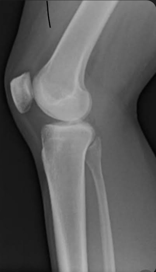 <p>Name the projection.</p><p>Should it be repeated, if so why?</p>