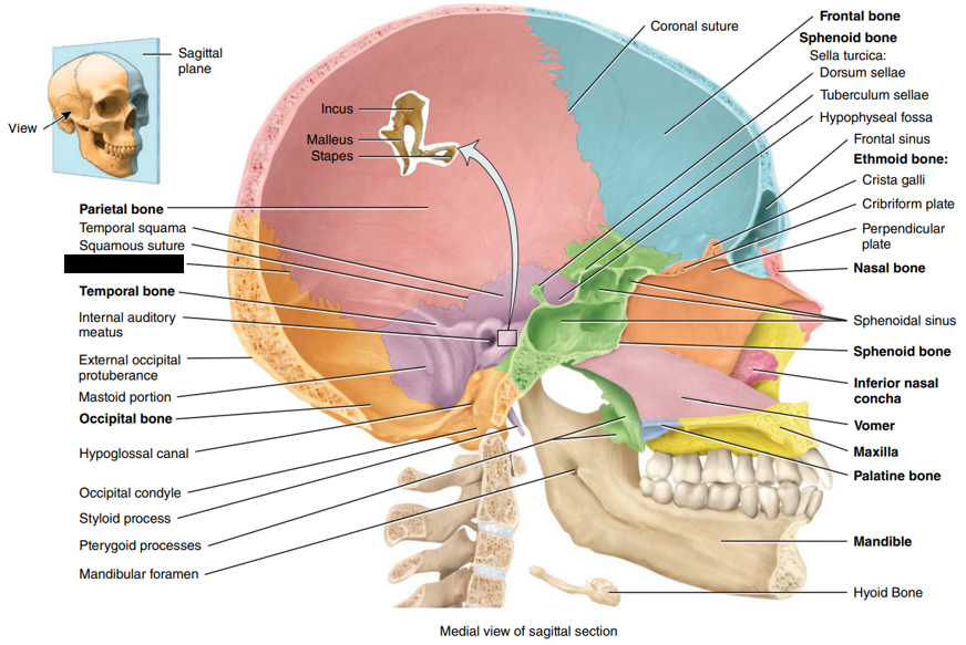 <p>State and identify what part of the cranial bone is being pointed out and censored. (hint: Suture)</p>