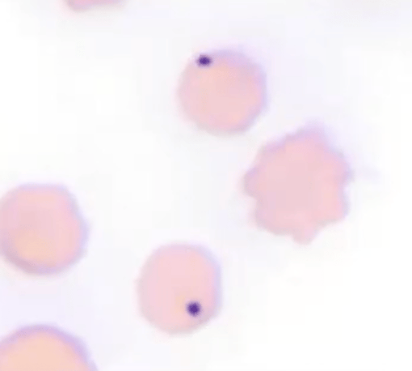 <p>- Nuclear remnants in mature RBCs; single dark inclusions</p>
